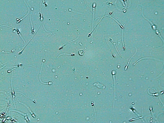 貯蔵精子は動物界共通で劣化する ― 昆虫から哺乳類まで30種を横断したメタ解析